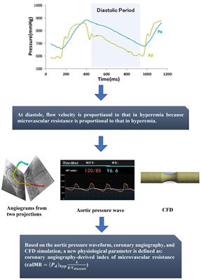 Frontiers | Coronary Angiography-Derived Index Of Microvascular Resistance